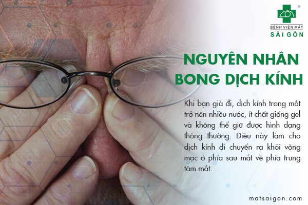 nguyên nhân bong dịch kính