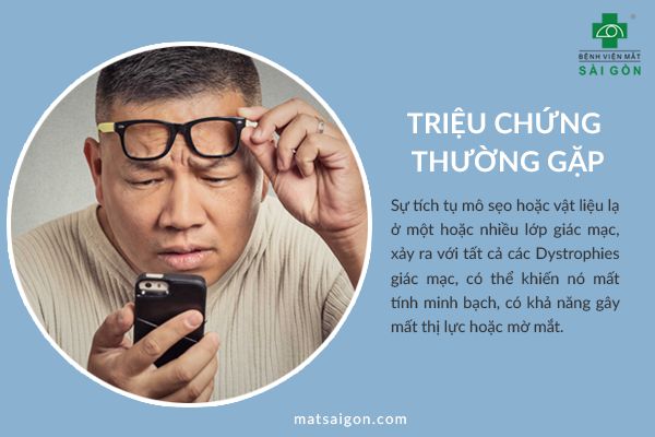 triệu chứng loạn dưỡng giác mạc