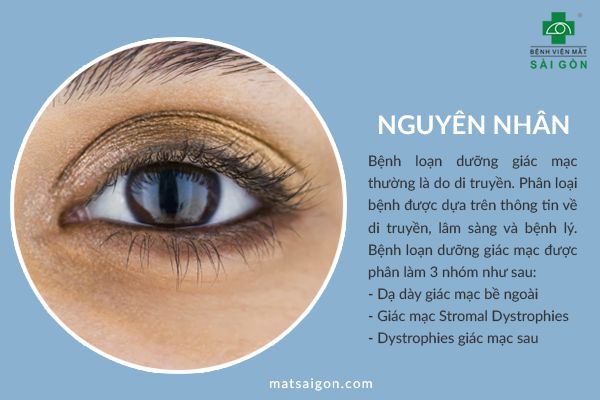 nguyên nhân loạn dưỡng giác mạc