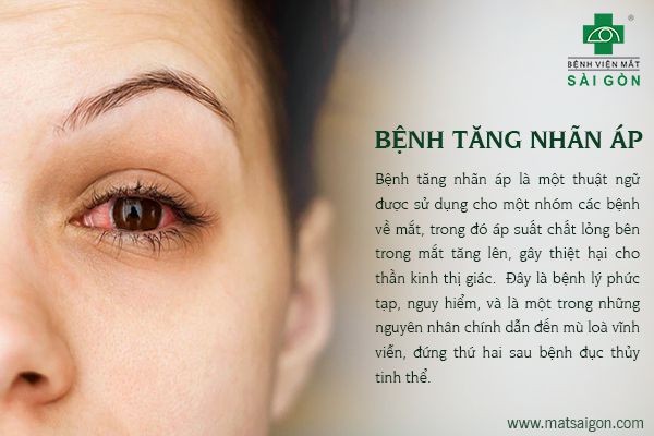 Những bệnh về mắt có nguy cơ mù lòa nếu không được chữa trị kịp thời-3