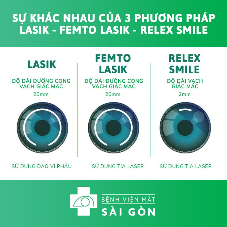 Phương pháp mổ cận tốt nhất hiện nay: Lựa chọn nào phù hợp cho bạn?