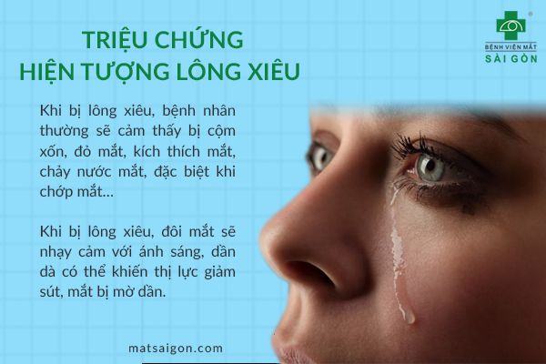 triệu chứng lông xiêu