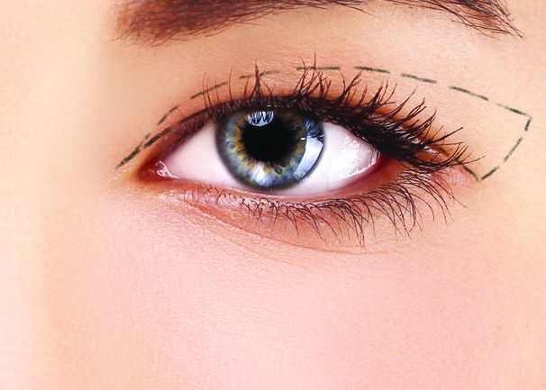 Bạn muốn mắt của mình trông to hơn, sâu hơn và đẹp hơn chỉ sau một thao tác đơn giản? Hãy đón xem hình ảnh về việc cắt mắt 2 mí của chúng tôi và tìm hiểu thêm về phương pháp này nhé!