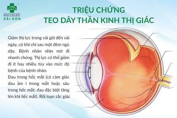 7. Các câu hỏi thường gặp về đau dây thần kinh hốc mắt